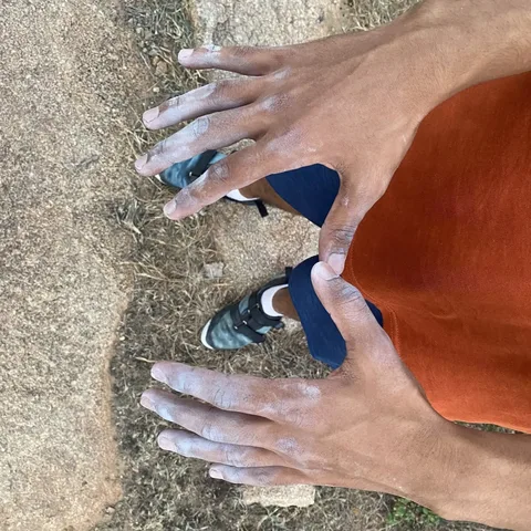 Halp. My knuckles are white from climbing.
